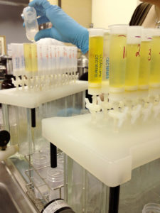 urine hormone test